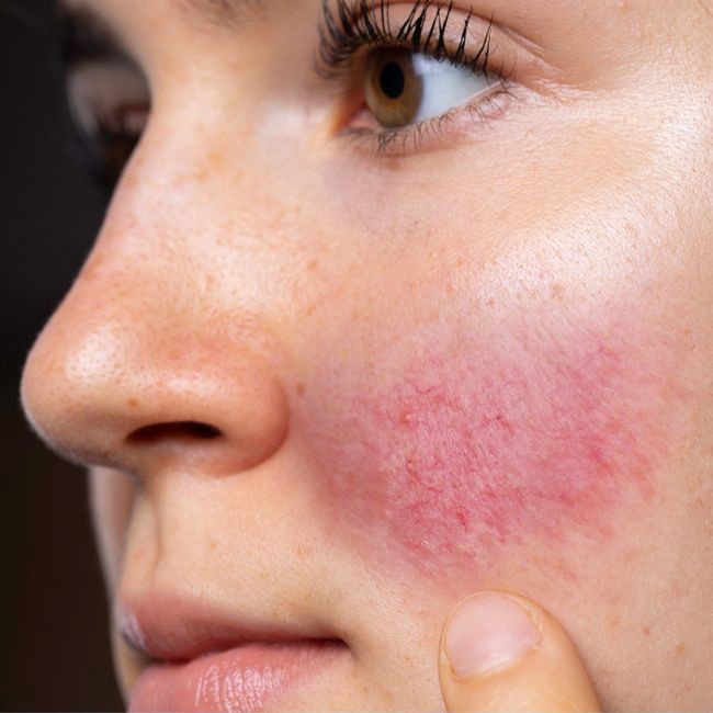 خطرات و عوارض استفاده از محصولات فیک و تقلبی