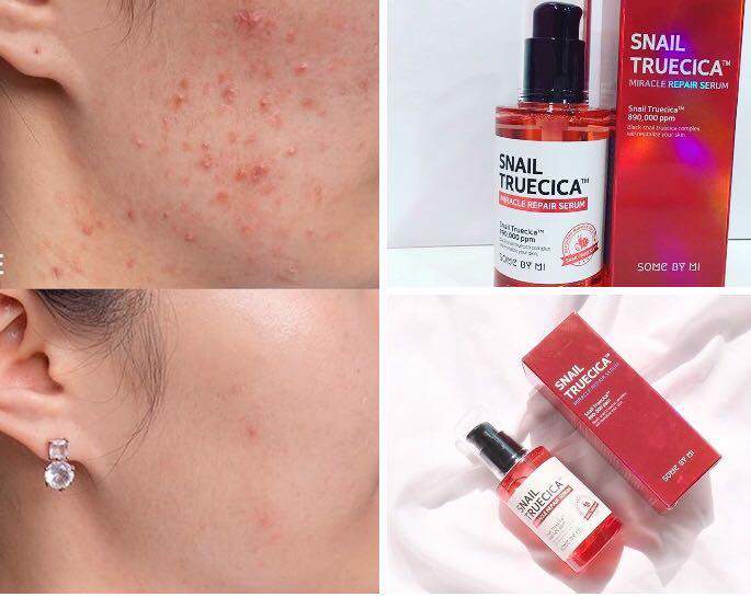 سرم ترمیم‌کننده حلزون سام بای می Some By Me Snail Truecica Serum — تصویر 3